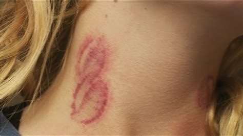 how to make hickey|hickey on breast meaning.